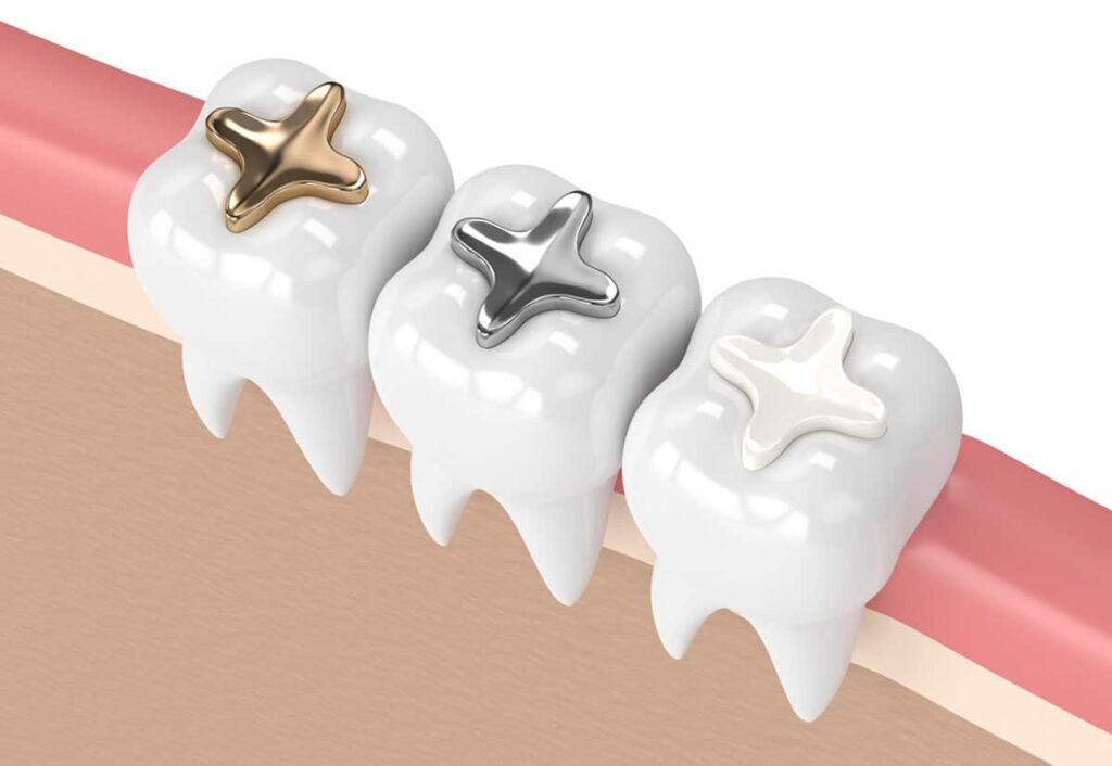 Dental Care